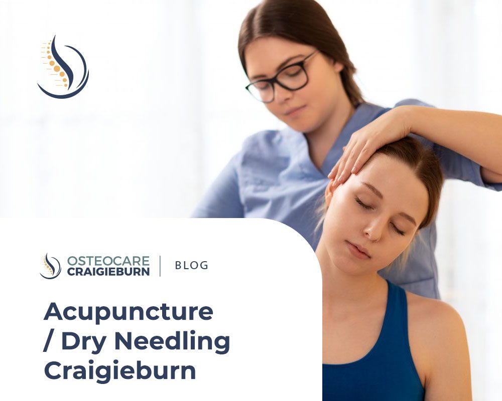 Acupuncture/ Dry Needling Craigieburn